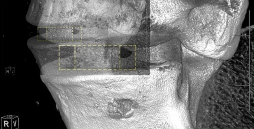 医用包装耗材怎么销售市场规模或超7000亿美元！医用高分子材料，高端市场国产替代空间广阔_https://www.jmylbn.com_新闻资讯_第3张