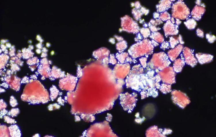 登上Nature头条，我国学者揭示微塑料的新危害——诱发脑血栓，导致神经行为异常-行业趋势|专塑视界|塑料在线